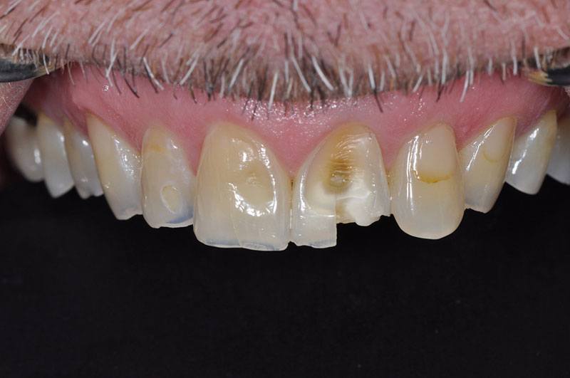 Gallery Dentist in Redding, CA