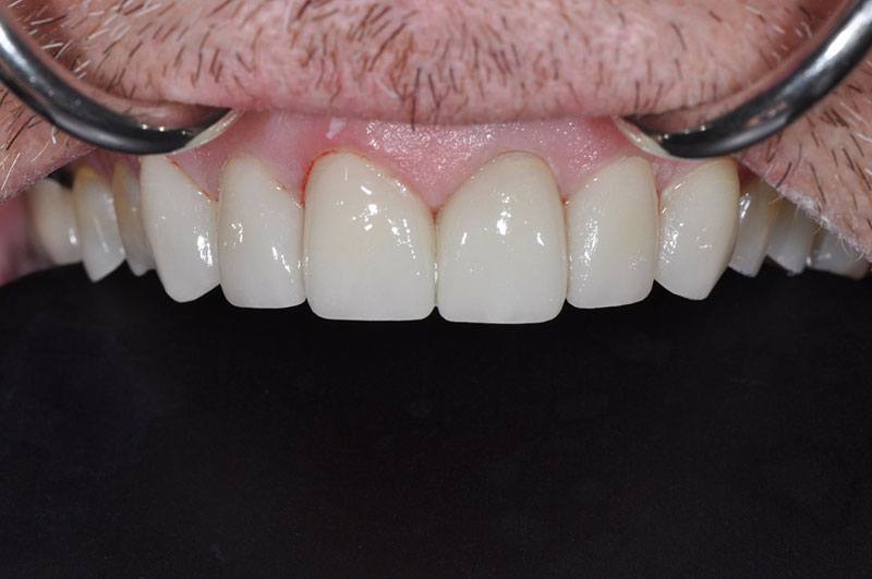 Gallery Dentist in Redding, CA