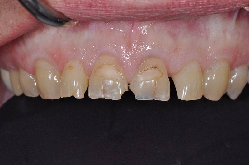 Gallery Dentist in Redding, CA